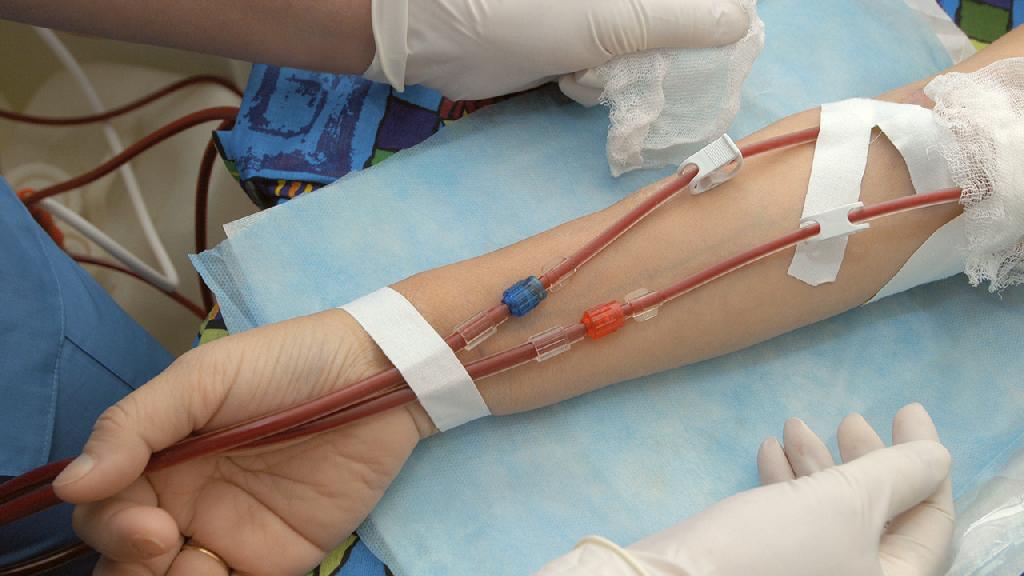 什么是血液透析 血液透析具体要怎么操作