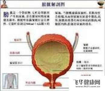 男性患有膀胱炎会尿出血吗?