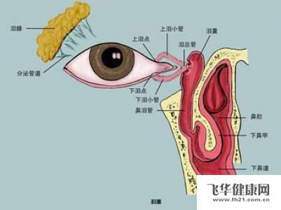 得了泪囊炎怎么办