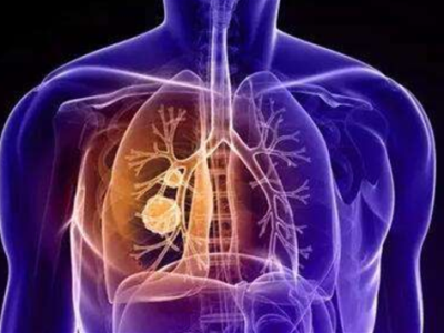肺的解剖结构图讲解