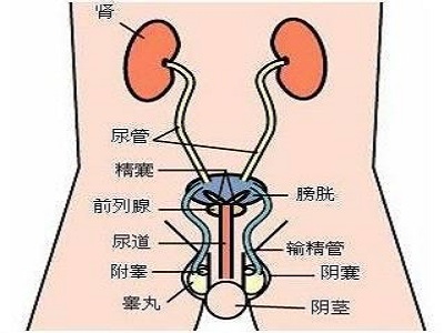 尿路结石的食疗辅助