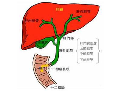 如何治疗肝内胆管结石