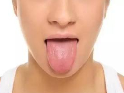 有裂纹性的舌炎有办法根治吗