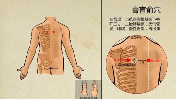 丁硼乳膏可以长期用吗  丁硼乳膏有副作用吗