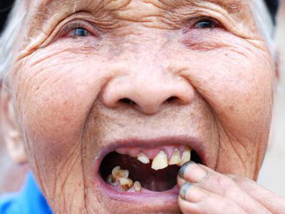 老人护理牙齿常犯的错误