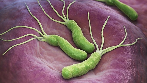 没有任何不适，但外阴部有尖锐湿疣