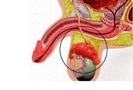 附睾位置图片图片