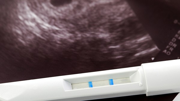 有宫外孕影响寿命吗