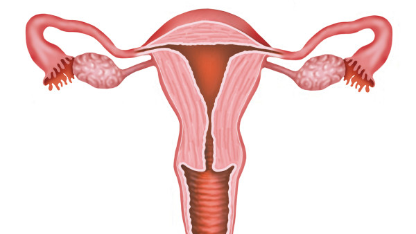 慢性子宫囊肿急性发作怎么办