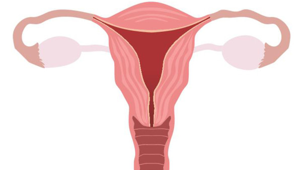 子宫腺肌症患者有哪些注意事项