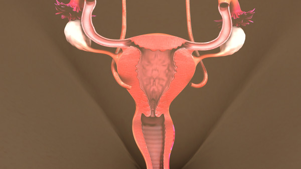 多囊卵巢综合征治愈方法