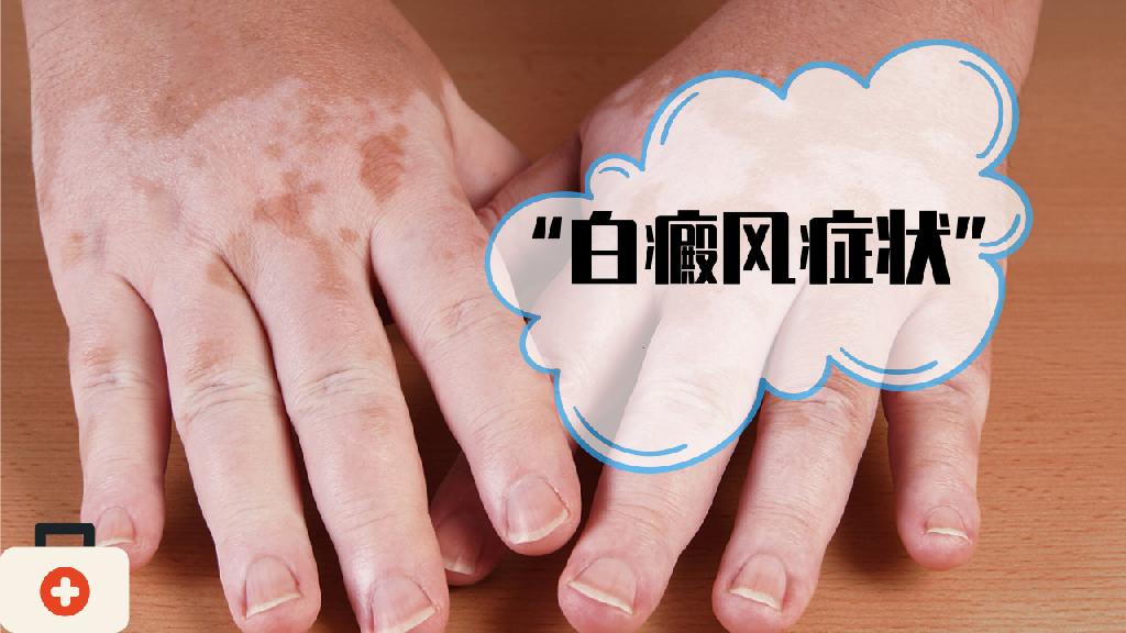 白癜风都有哪些症状呢