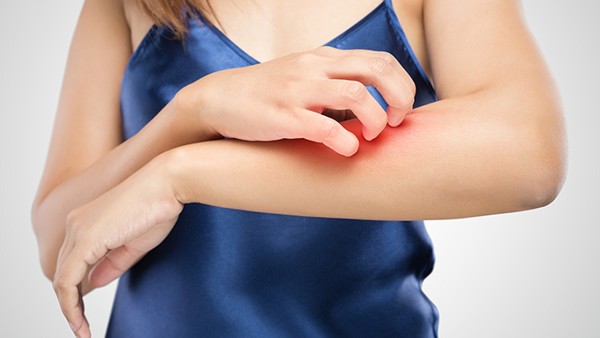 常见的牛皮癣预防方法有哪些