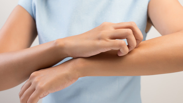 如何预防皮肤瘙痒发作
