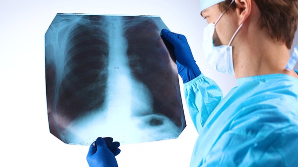 肺癌晚期转移肝脏怎么办