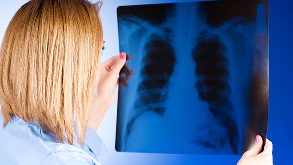 肺癌能治愈且不复发吗