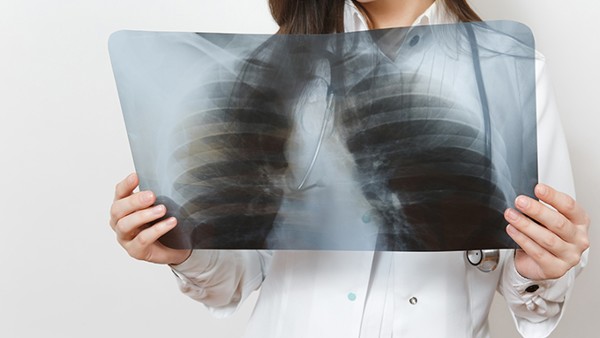 肺癌在什么情况下传染