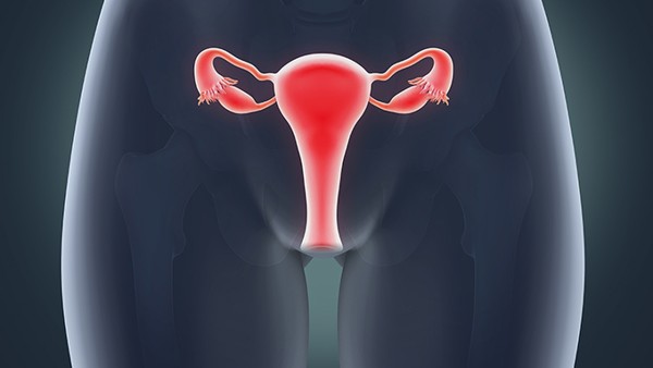 如何防止卵巢癌复发