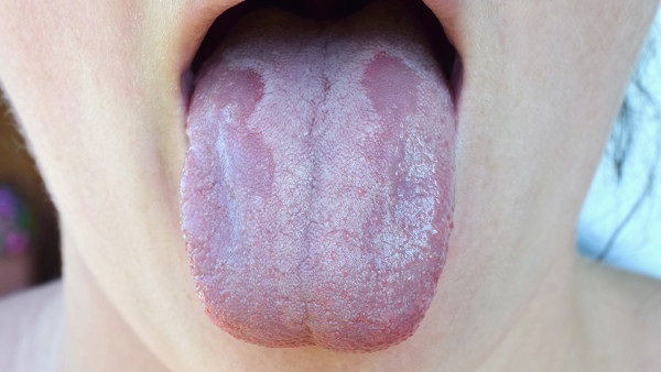 舌癌的危害有哪些