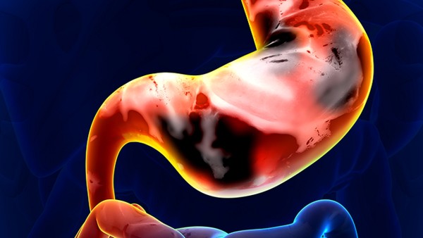 慢性胃炎有哪些危害表现