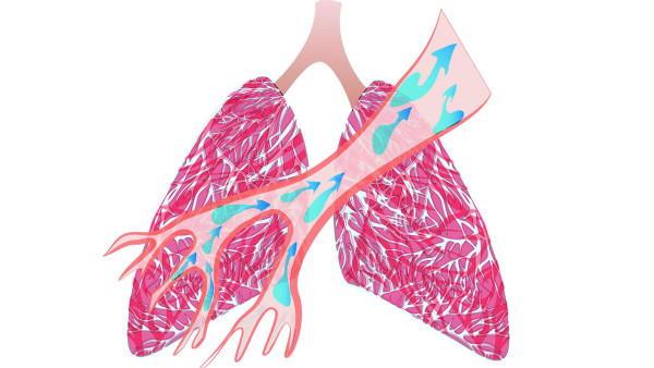 慢阻肺的诊断方法是什么