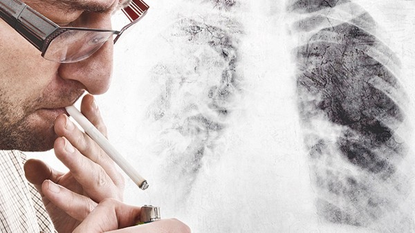 肺纤维化的鉴别诊断