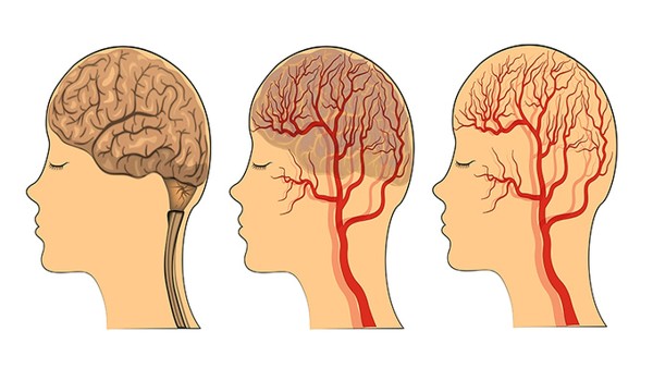 垂体瘤的检查方法费用是多少