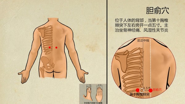 胆囊结石的四大治疗原则是什么呢