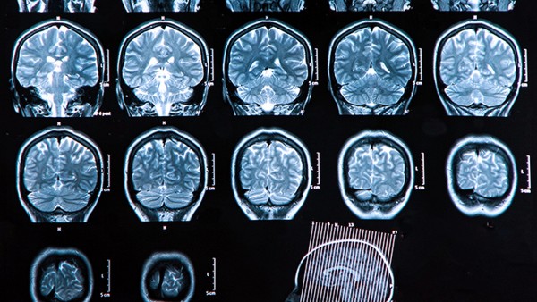 患者一定要重视软组织损伤的诊断依据