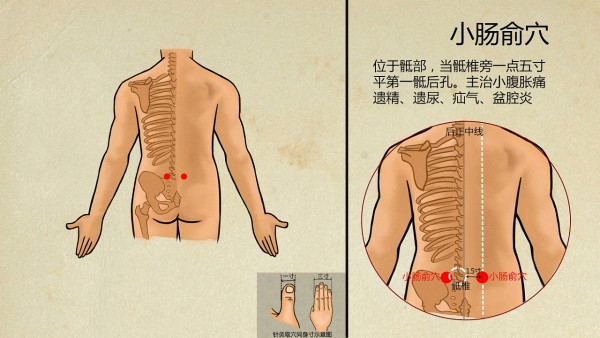 肛门息肉的诊断方法集锦