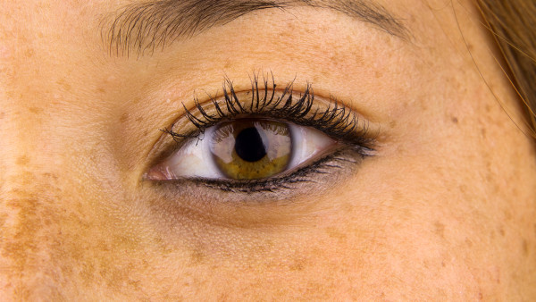 女性会患上怎样的阴道炎的症状表现