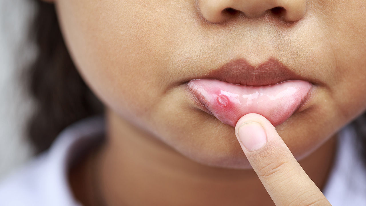 小儿急性喉炎对孩子有哪些危害