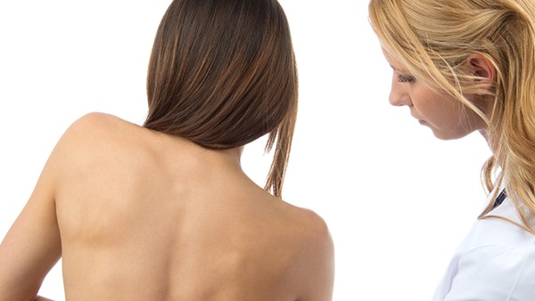 什么叫做黄褐斑