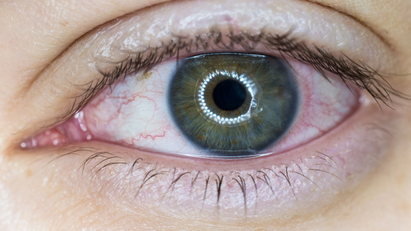 视网膜脱落中药可治愈吗