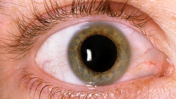 一般从哪方面预防视网膜脱落