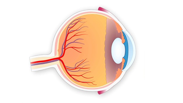 视网膜脱落治愈率是多少
