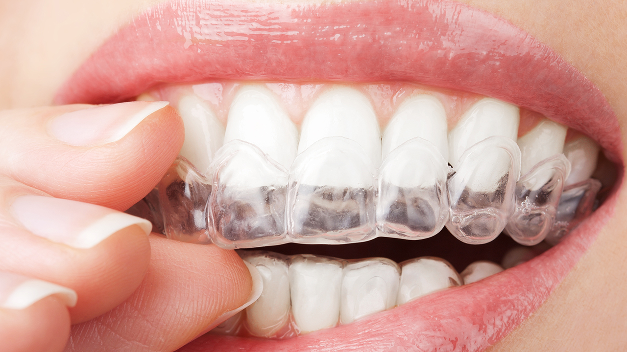 牙龈萎缩疾病护理的方法有哪些