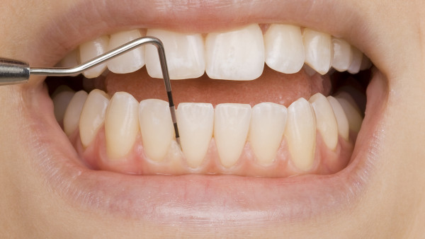 治疗牙龈萎缩有什么办法