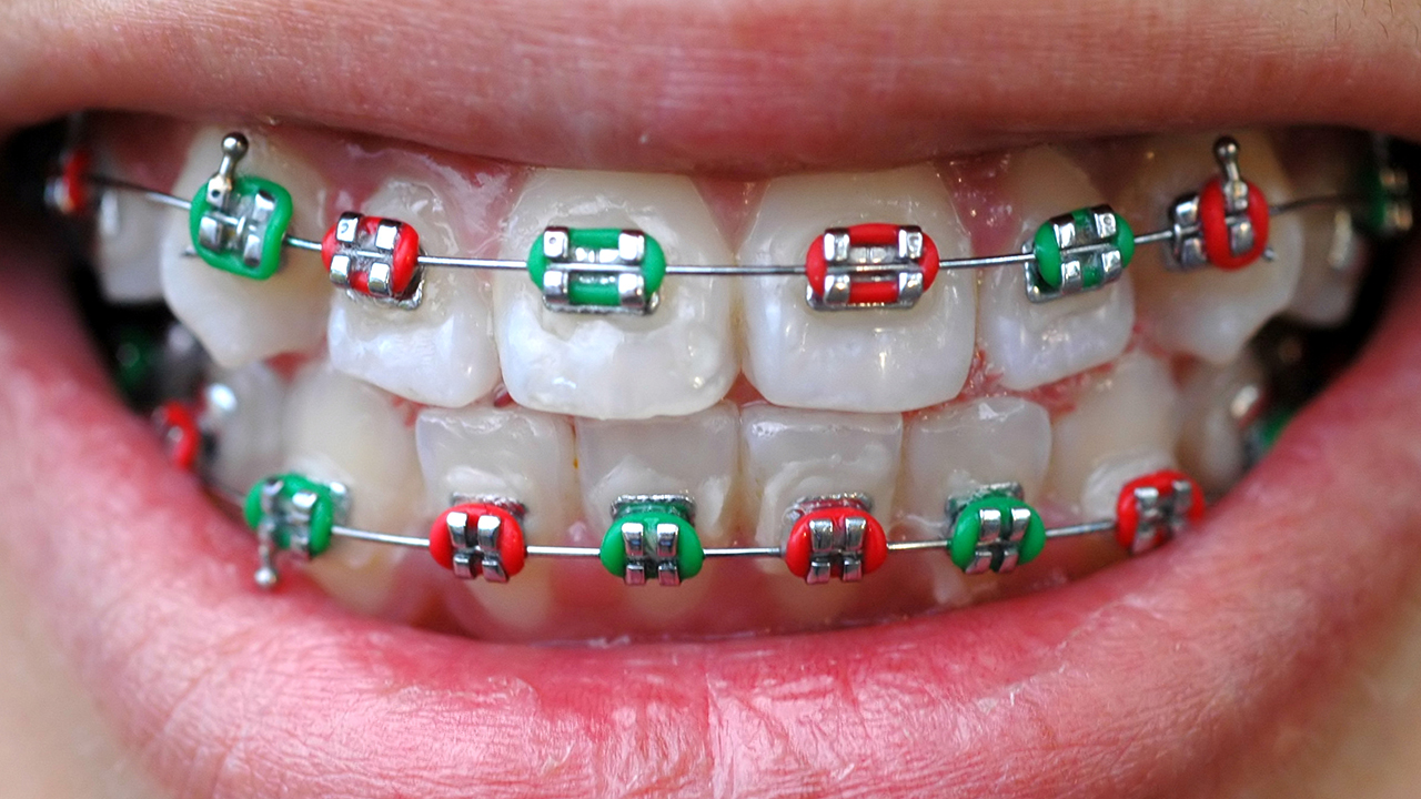 磨牙的最有效的治疗方法是什么