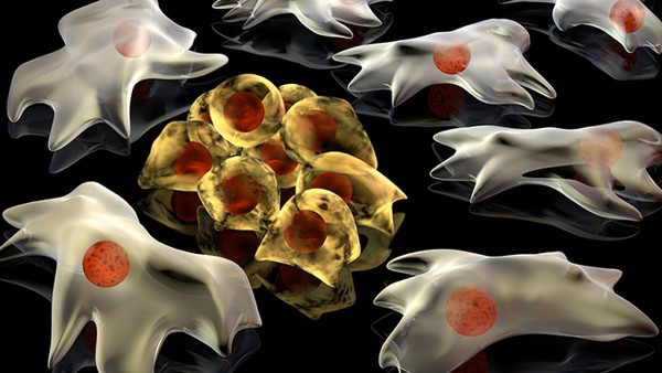 尖锐湿疣是怎么引起的呢