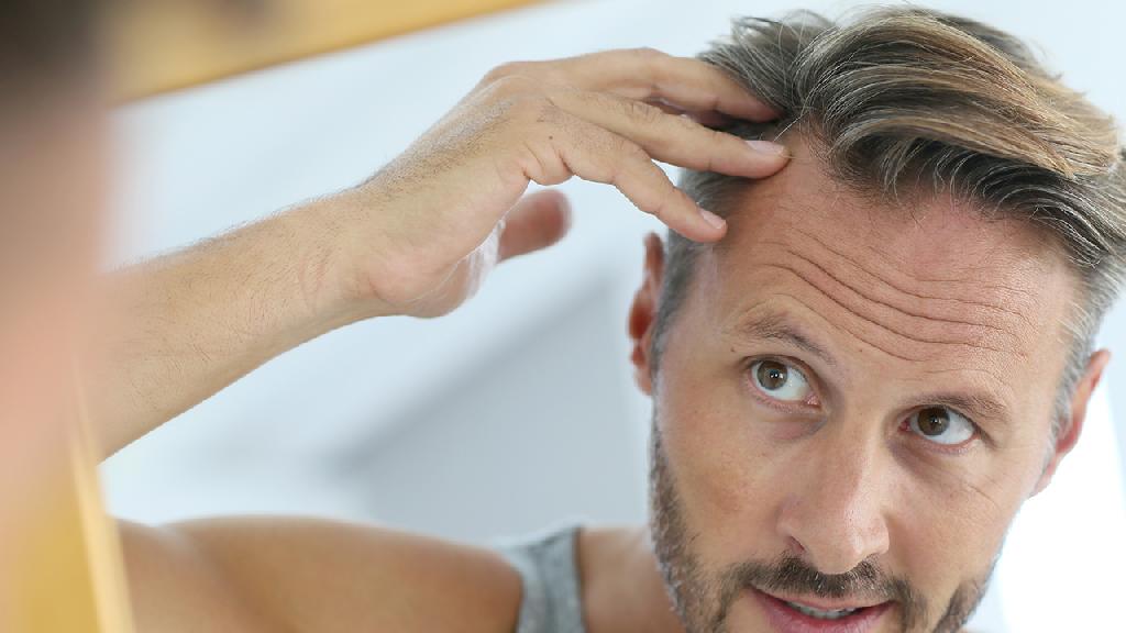 为什么男性更易发生秃顶