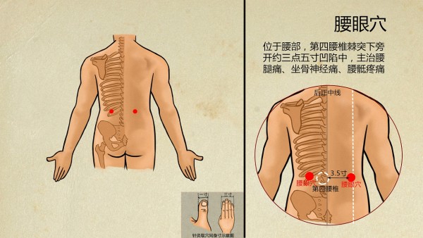 什么因素导致眼结石的发生