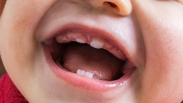 四环素牙患者的饮食禁忌是什么