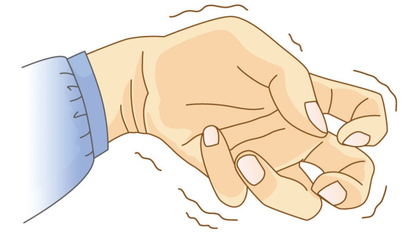 手癣初步诊断方法