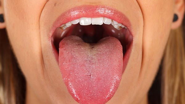 地图舌是什么疾病