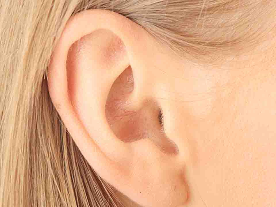 不可忽视全耳再造5个手术细节