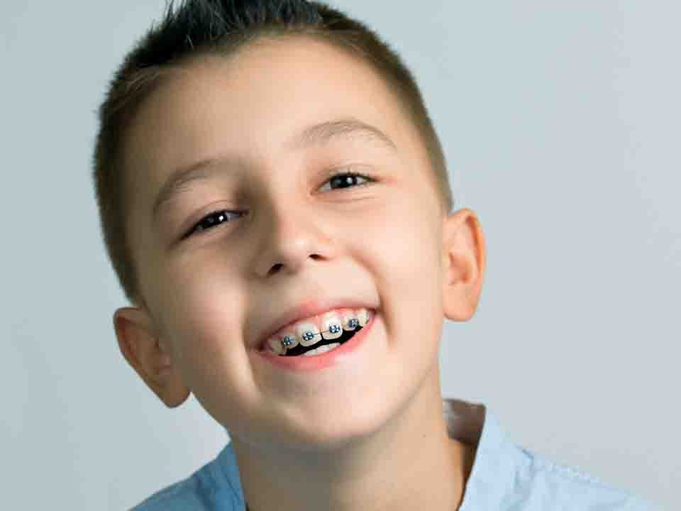 解析：牙齿矫正的最佳年龄是几岁