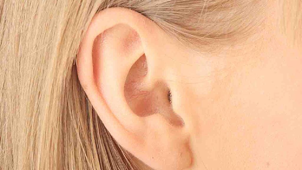 矫正治疗招风耳美丽从耳部开始