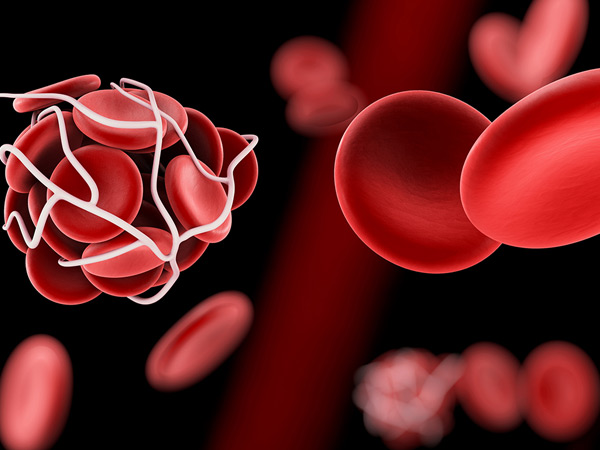 血小板减少患者血浆置换时应进行抗凝