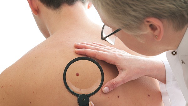 皮肤癌活检能否第一时间发现皮肤恶性病变？ 皮肤癌怎么治疗？